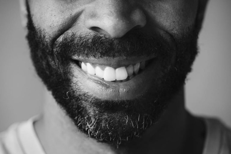 Dientes