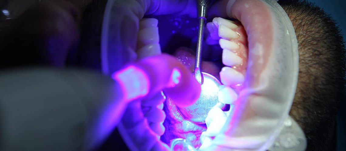 dentist-g2ff3b26ac_1280(FILEminimizer)