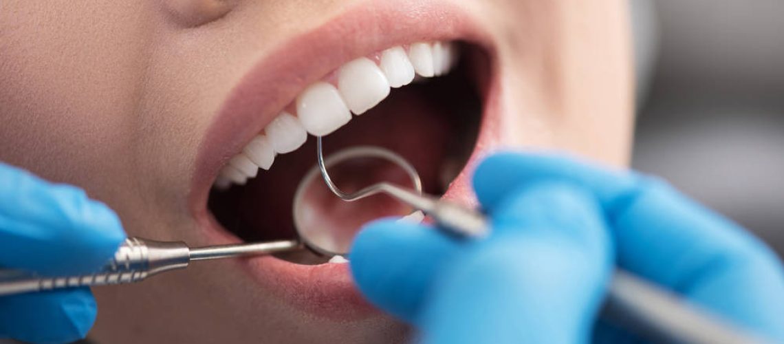 shutterstock_667433431(FILEminimizer)